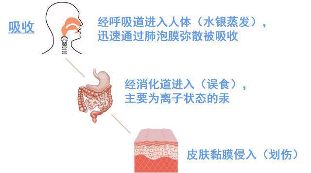 生活百科 水银体温计打碎了怎么办？会开云 开云体育官网中毒吗？